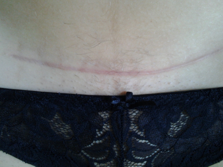 Спасибо тебе, о великий и могучий Контрактубекс!