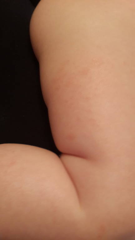 пришли от дерматолога