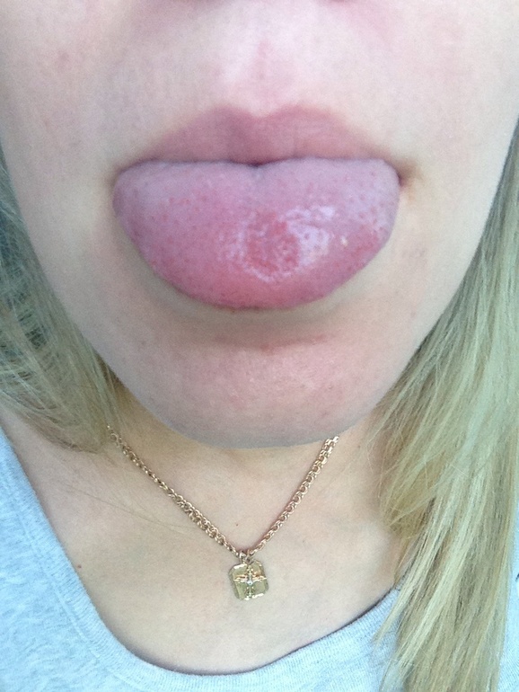 Пятно на языке