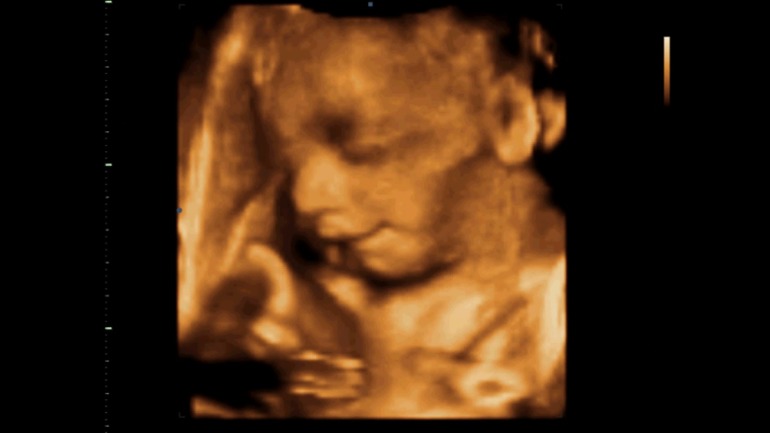 Узи, 31 неделя и 1 день.