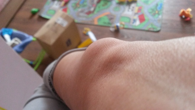 суставы на запястьях