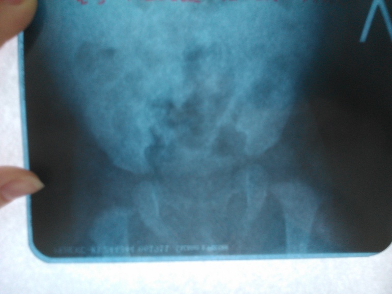 Результаты нашего рентгена