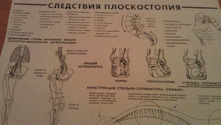С ногами...или без:)