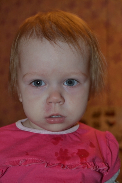 наши 5 ОБРАБОТОК в РОНЦ
