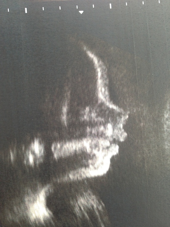 Были в ЦИРе на узи:)